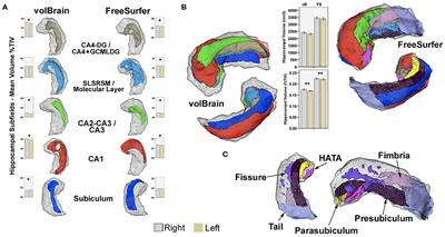 Diagnostic Performance of MRI Volumetry in Epilepsy Patients With Hippocampal Sclerosis Supported Through a Random Forest Automatic Classification Algorithm
